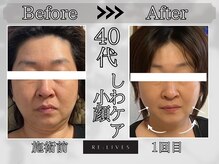 リライブ 金町店(Re:Lives)の雰囲気(レモンボトル&レッドショットで30代~からの小顔美肌を実現♪)