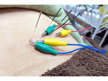 ヤマグチ美容整体院の写真/【長崎市】鍼灸で巡りを整え、寝ても取れない疲れやだるさ、腰や肩の不調にサヨナラしませんか？【土日◎】