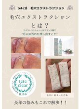 リュクラ オムエピ(Luxla Homme.epi)/毛穴エクストラクション