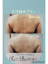 RiとBiのたまご/(ブライダル)引き締め