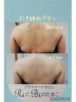 RiとBiのたまご/(ブライダル)引き締め