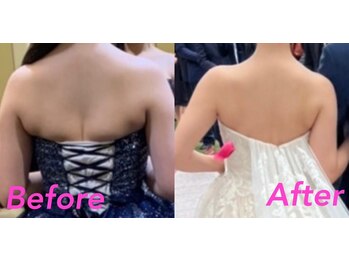 ハッピーエンジェル(Happy Angel)/ブライダル集中ケア