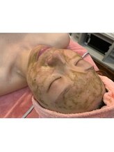 オアシス ビューティー 川口店(OASIS Beauty)/【ハーブピーリング】【毛穴】