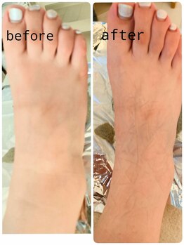 サロンドットブレスドットケイ(salon.bless.k)/足タラソテラピーパック