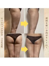 エソール(essor)/固いお肉がなめらか綺麗に！