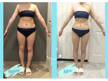 千歳の女神 三河安城店/【施術風景】Before/After