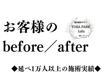 ヨサ パーク ルル(YOSA PARK Lulu)/お客様のbefore/after