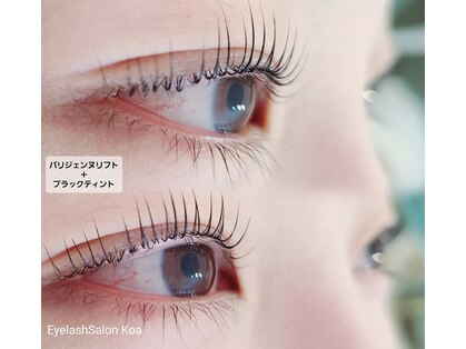 コア(Koa)の写真