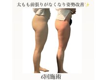 痩身革命 大宮店/ダイエットリンパマッサージ