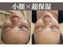 マヴィ 守口店(MavY.)/超保湿♪しっとりもっちり♪