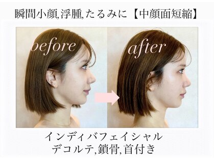 ナルシス(Narcissus)の写真