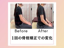 あすと長町整骨院/1回の骨格矯正での変化