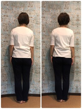 ミーテ(mite)/肩周りの不調に