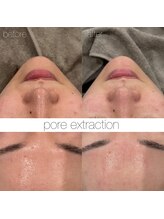 アンク(Ankh)/皮脂の分泌を抑え毛穴がしまる