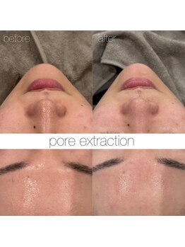 アンク(Ankh)/皮脂の分泌を抑え毛穴がしまる