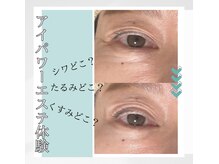 リヒト(Licht)の雰囲気（アイパワーエステ体験のお客様※初回限定お試しクーポン発券中♪）