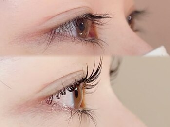 アイリーン(Eyeleen)/before after★