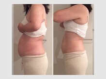 カロン 銀座(Kalon)/【腸もみ90分】1回結果！