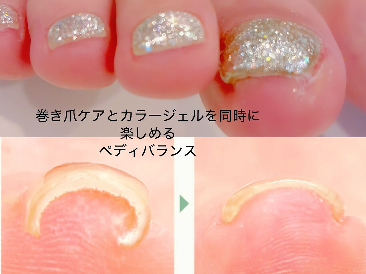 ペディバランス　ジェル ペディバランス ジェル 人気順｜#ペディバランスのネイル
