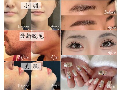 メイプル(Maple)の写真