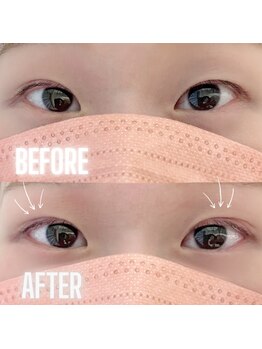 テュセ(Tu sais)/アイストレッチでパッチリ目に！