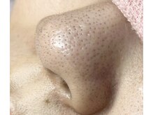 サロン モウ(mou。)の雰囲気(カウンセリングであなたの毛穴に合ったケア方法で綺麗なお肌へ。)