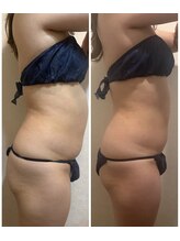 コマ(KOMA)/4回目☆