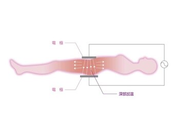 アンジェリーク(ANGELIQUE)/【インディバ２】