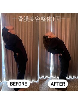 アイミーボーテ(Aime beaute)/骨膜美容整体