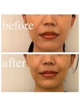 ディス イズ ミー エステティック(This is Me Aesthetic)/劇的リフトアップ