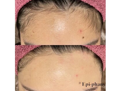 エピファニー(Epi phany Total Beauty Salon)の写真