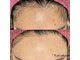 エピファニー(Epi phany Total Beauty Salon)の写真