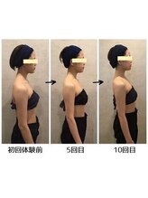 小顔フェイスラボ 桑名店(小顔FaceLabo.)/◆小顔&整体コルギで姿勢改善◆