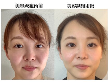 サプル(supple)の写真