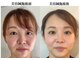 サプル(supple)の写真
