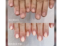 エッセンス (Essence)/深爪改善,美爪育成をご希望の方