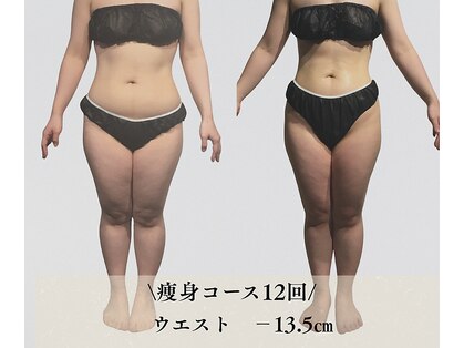 サンテボーテ(Sante Beaute)の写真