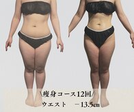 サンテボーテ(Sante Beaute)