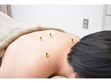 カリーナ(Carina)/お灸