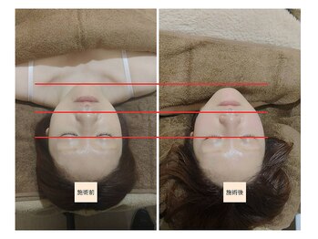 吉川美南ライフ整骨院/30代女性