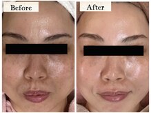 ルアナ 柏店(LUANA)の雰囲気（水光肌・PDRNケア毛穴・くすみ・乾燥に人気の艶肌ケア）