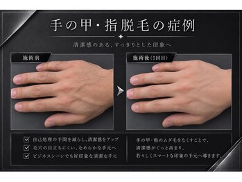 メンズラボ 京都山科店/営業職・接客業にも人気