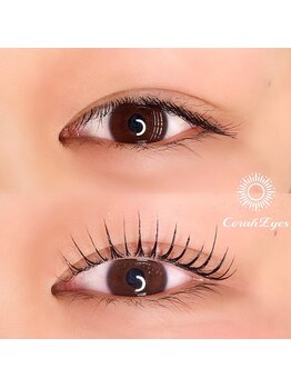 チュラアイズ(CerahEyes)/【お客様ビフォーアフター】