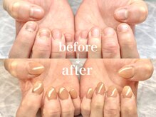ネイルサロン オー(Oh!)/劇 的☆深爪改善！Before→After