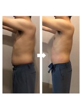 伊達男/フォースカッター事例