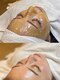 レイビューティサロン(Lei beauty salon)の写真/【リピート率90%超!】話題の松ヤニワックスで光り輝く水光肌が手に入る♪透明感爆上げのフェイスワックス＊