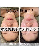 マリアム(mariam)/プラズマと導入で輝く水光肌に