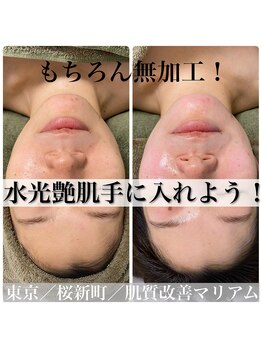 マリアム(mariam)/プラズマと導入で輝く水光肌に