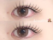 アイルーム312(eyeroom 312)/- アンドヘルシー -