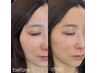 平日限定！鼻下脱毛付き【眉毛アイブロウ】ハリウッドブロウリフトWAX脱毛